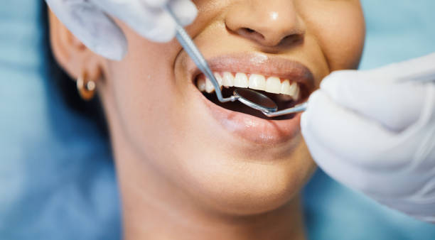 Best Emergency Root Canal Therapy in Akron, OH